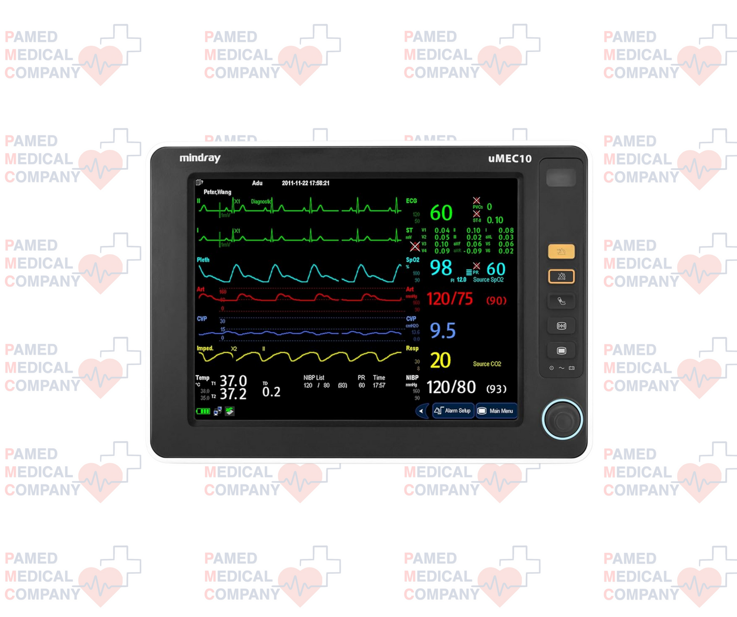 Monitor De Signos Vitales